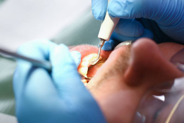 Best Cracked Tooth Emergency Dentist  in Palo Alto, CA